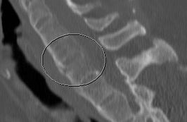 Sagitale Rekonstruktion einer Computertomografie