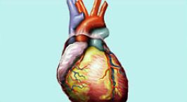 Ist ein Herzkranzgefäß verschlossen, kommt es zum Herzinfarkt.