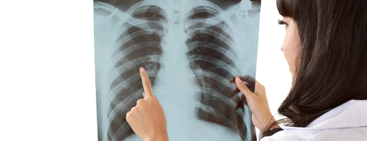 Ärztin betrachtet Röntgenbild